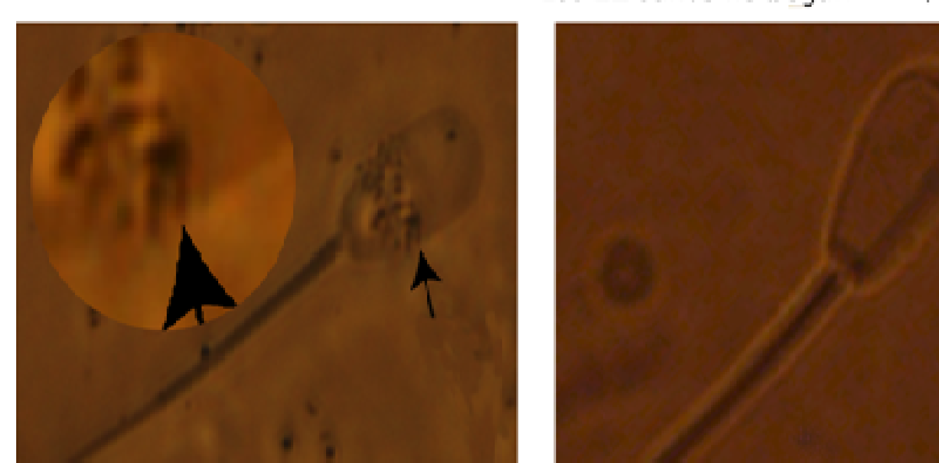 Espermatozoides, microscopio optico, reactivos a las nanoparticulas, no reactivos, nanosemen, fertilidad, INTI